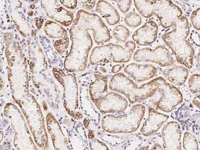Immunohistochemistry-Paraffin: SDHB Antibody [NBP2-99066] - Immunochemical staining of human SDHB in human kidney with rabbit polyclonal antibody (1:1000, formalin-fixed paraffin embedded sections).