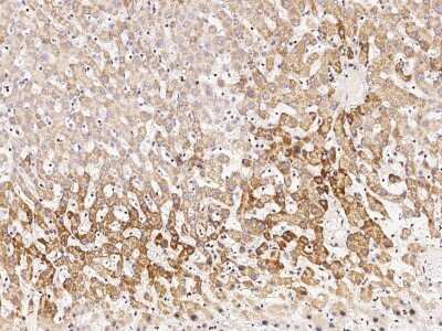 Immunohistochemistry-Paraffin: SDHB Antibody [NBP2-99066] - Immunochemical staining of human SDHB in human liver with rabbit polyclonal antibody (1:1000, formalin-fixed paraffin embedded sections).