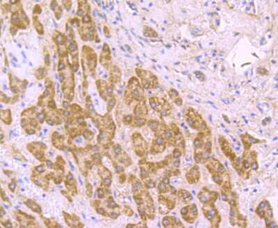 Immunohistochemistry-Paraffin: SDHB Antibody (JU02-33) [NBP2-75658] - Analysis of paraffin-embedded human liver tissue using anti-SDHB antibody. Counter stained with hematoxylin.