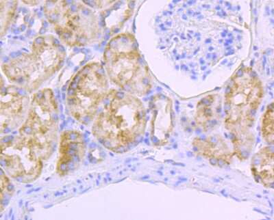 Immunohistochemistry-Paraffin: SDHB Antibody (JU02-33) [NBP2-75658] - Analysis of paraffin-embedded human kidney tissue using anti-SDHB antibody. Counter stained with hematoxylin.