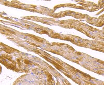 Immunohistochemistry-Paraffin: SDHB Antibody (JU02-33) [NBP2-75658] - Analysis of paraffin-embedded mouse heart tissue using anti-SDHB antibody. Counter stained with hematoxylin.