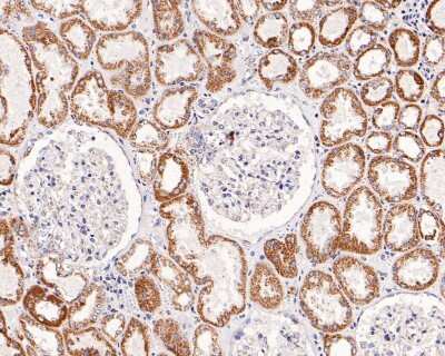 Immunohistochemistry-Paraffin: SDHB Antibody (JU02-33) [NBP2-75658] - Analysis of paraffin-embedded human kidney tissue with Rabbit anti-SDHB antibody washed with ddH2O and PBS, and then probed with the primary antibody  at 1/50 dilution for 0.5 hour at room temperature. The detection was performed using an HRP conjugated compact polymer system. DAB was used as the chromogen. Tissues were counterstained with hematoxylin and mounted with DPX.