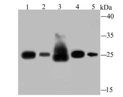 Western Blot: SDHB Antibody (JU02-33) [NBP2-75658] - Analysis of SDHB on different lysates using anti-SDHB antibody at 1/500 dilution.Positive control:Lane 1: Human liver   Lane 2: Rat spleenLane 3: Rat liver     Lane 4: Mouse spleenLane 5: HepG2