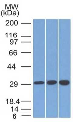 Western Blot: SDHB Antibody (SDHB/2126) - Azide and BSA Free [NBP3-08809] - Western Blot Analysis of 1) 293; 2) Jurkat and 3) HepG2 Cell Lysate with SDHB Mouse Monoclonal Antibody (SDHB/2126).