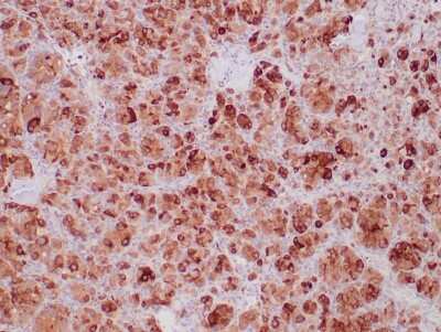 Immunohistochemistry-Paraffin: SDHB Antibody (SDHB/6697R) - Azide and BSA Free [NBP3-08827] - Formalin-fixed, paraffin-embedded human paraganglioma stained with SDHB Recombinant Rabbit Monoclonal Antibody (SDHB/6697R).