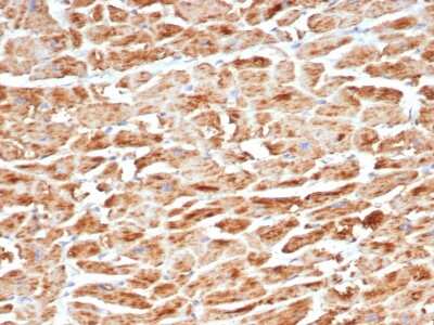 Immunohistochemistry-Paraffin: SDHB Antibody (SDHB/6697R) - Azide and BSA Free [NBP3-08827] - Formalin-fixed, paraffin-embedded human heart stained with SDHB Recombinant Rabbit Monoclonal Antibody (SDHB/6697R).