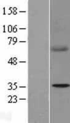 Western Blot: SDHB Overexpression Lysate (Adult Normal) [NBL1-15766] Left-Empty vector transfected control cell lysate (HEK293 cell lysate); Right -Over-expression Lysate for SDHB.