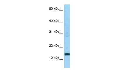 Western Blot: SDHC Antibody [NBP2-86795] - WB Suggested Anti-SDHC Antibody. Titration: 1.0 ug/ml. Positive Control: THP-1 Whole Cell