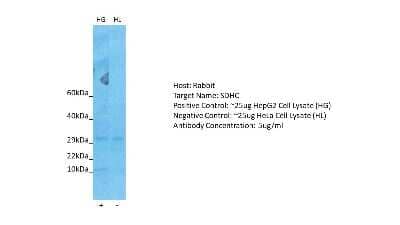 Western Blot: SDHC Antibody [NBP2-86795] - Host: Rabbit. Target: SDHC. Positive control (+): HepG2 Cell Lysate (HG). Negative control (-): HeLa Cell Lysate (HL). Antibody concentration: 5ug/ml