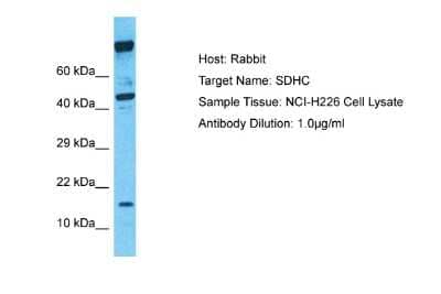 Western Blot: SDHC Antibody [NBP2-86796] - Host: Rabbit. Target Name: SDHC. Sample Type: NCI-H226 Whole cell lysates. Antibody Dilution: 1.0ug/ml