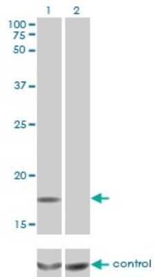 Western Blot: SDNSF/MCFD2 Antibody (3A5-G4) [H00090411-M01] - Analysis of MCFD2 over-expressed 293 cell line, cotransfected with MCFD2 Validated Chimera RNAi ( Cat # H00090411-R01V ) (Lane 2) or non-transfected control (Lane 1). Blot probed with MCFD2 monoclonal antibody (M01), clone 3A5-G4 (Cat # H00090411-M01 ). GAPDH ( 36.1 kDa ) used as specificity and loading control.