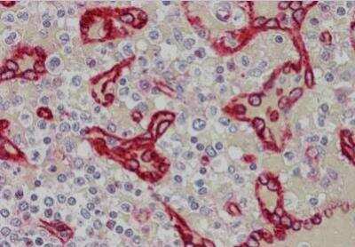 Immunohistochemistry SDPR Antibody