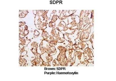 Immunohistochemistry: SDPR Antibody [NBP1-74112] - Human placental tissue Primary Antibody Dilution: 1 : 50 Secondary Antibody: Goat anti rabbit-HRP Secondary Antibody Dilution: 1 : 10,000Color/Signal Descriptions: Brown: SDPRPurple: Haemotoxylin Gene name: Sdpr Submitted by: Dr. Hiten D. Mistry and Anna