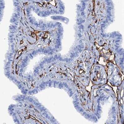 Immunohistochemistry-Paraffin: SDPR Antibody [NBP1-86610] - Staining of human Fallopian tube shows strong membranous positivity in endothelial cells.