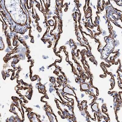 Immunohistochemistry-Paraffin: SDPR Antibody [NBP1-86610] - Staining of human lung shows strong membranous positivity in pneumocytes.