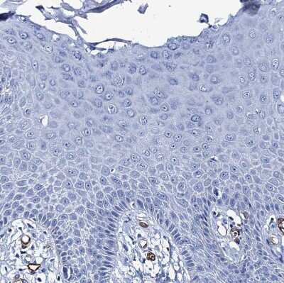 Immunohistochemistry-Paraffin: SDPR Antibody [NBP1-86610] - Staining of human skin shows no positivity in squamous epithelial cells.