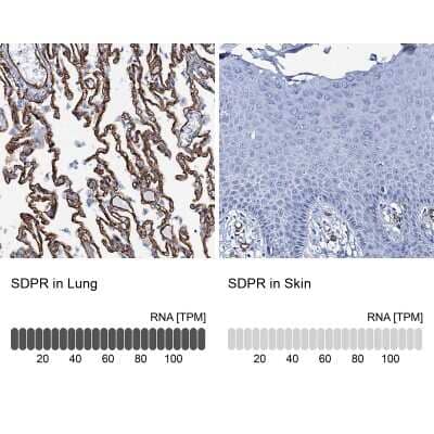 <b>Orthogonal Strategies Validation. </b>Immunohistochemistry-Paraffin: SDPR Antibody [NBP1-86610] - Analysis in human lung and skin tissues using NBP1-86610 antibody. Corresponding SDPR RNA-seq data are presented for the same tissues.