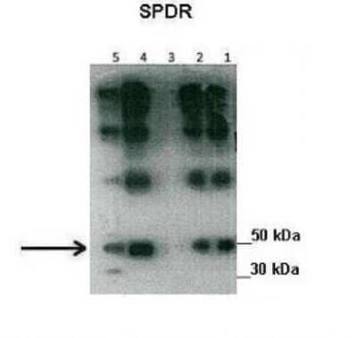 Western Blot: SDPR Antibody [NBP1-74112] - Lanes: Lane1 : 30 ug human placental tissue lysate Lane2: 30 ug human placental tissue lysate Lane3: 30 ug human placental tissue lysate Lane4: 30 ug human placental tissue lysate Lane5: 20 ug human myometrial tissue lysate Primary, Antibody Dilution: 1 : 500 Secondary Antibody: Goat anti-rabbit HRP Secondary, Antibody Dilution: 1 : 10000 Gene name: SDPR.