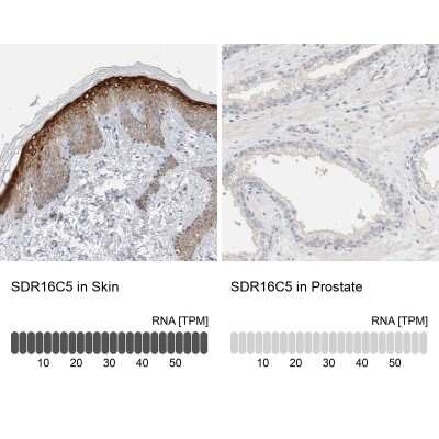 Immunohistochemistry-Paraffin: SDR16C5 Antibody [NBP1-87150] - Analysis in human skin and prostate tissues. Corresponding SDR16C5 RNA-seq data are presented for the same tissues.