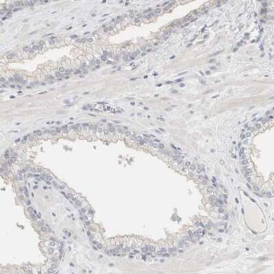 Immunohistochemistry-Paraffin: SDR16C5 Antibody [NBP1-87150] - Staining of human prostate shows no positivity in glandular cells as expected.