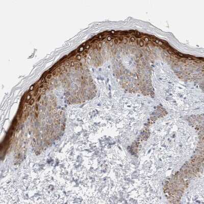 Immunohistochemistry-Paraffin: SDR16C5 Antibody [NBP1-87150] - Staining of human skin shows strong cytoplasmic positivity in squamous epithelial cells.