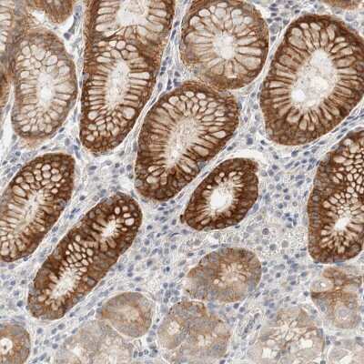 Immunohistochemistry-Paraffin: SDR16C5 Antibody [NBP1-87150] - Staining of human stomach shows strong cytoplasmic positivity in glandular cells.