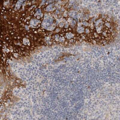 Immunohistochemistry-Paraffin: SDR16C5 Antibody [NBP1-87150] - Staining of human tonsil shows strong cytoplasmic positivity in squamous epithelial cells.