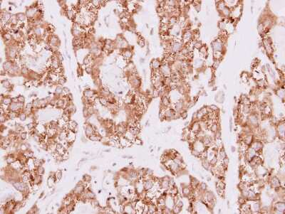 Immunohistochemistry-Paraffin: SDR16C5 Antibody [NBP2-20277] - Immunohistochemical analysis of paraffin-embedded MDA-MB468 xenograft, using antibody at 1:100 dilution.