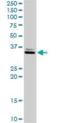 Western Blot: SDR16C5 Antibody [H00195814-D01P] - Analysis of RDHE2 expression in mouse liver.