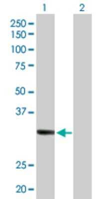 Western Blot: SDR16C5 Antibody [H00195814-D01P] - Analysis of SDR16C5 expression in transfected 293T cell line by SDR16C5 polyclonal antibody.Lane 1: RDHE2 transfected lysate(34.10 KDa).Lane 2: Non-transfected lysate.