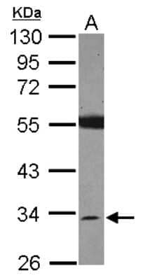 Western Blot: SDR16C5 Antibody [NBP2-20277] - Sample (30 ug of whole cell lysate) A: IMR32 10% SDS PAGE gel, diluted at 1:5000.