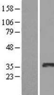 Western Blot: SDR16C5 Overexpression Lysate (Adult Normal) [NBL1-15260] Left-Empty vector transfected control cell lysate (HEK293 cell lysate); Right -Over-expression Lysate for SDR16C5.