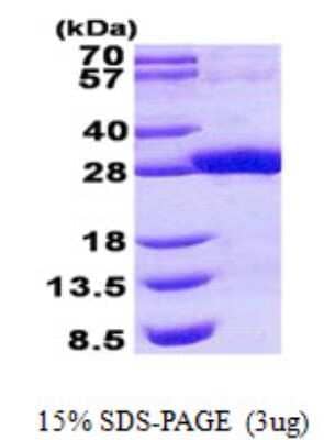 SDS-Page: SDR16C5 Protein [NBP2-23469]