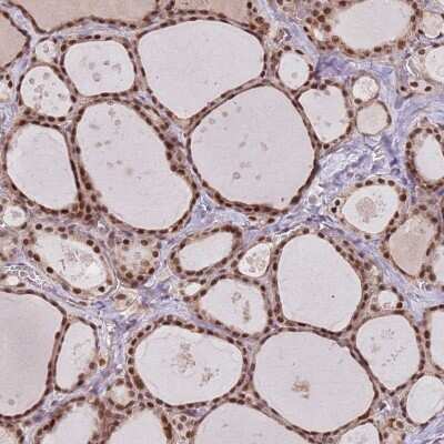 Immunohistochemistry-Paraffin: SDS3 Antibody [NBP2-48751] - Staining of human thyroid gland shows strong nuclear positivity in glandular cells.