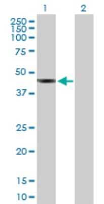 Western Blot: SDS3 Antibody [H00064426-B01P] - Analysis of SUDS3 expression in transfected 293T cell line by SUDS3 polyclonal antibody.  Lane 1: SUDS3 transfected lysate(36.08 KDa). Lane 2: Non-transfected lysate.