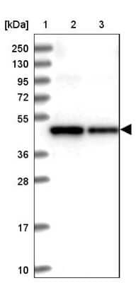 Western Blot SDS3 Antibody - BSA Free