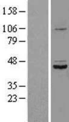 Western Blot SDS3 Overexpression Lysate