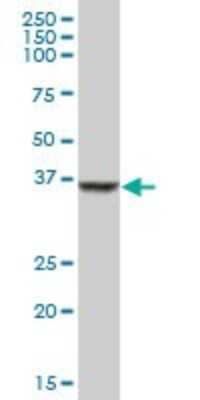 Western Blot: SDSL Antibody [H00113675-B01P] - Analysis of SDSL expression in human liver.
