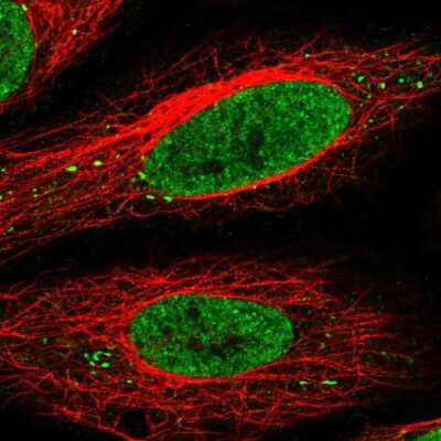 Immunocytochemistry/Immunofluorescence: SEC13 Antibody [NBP2-58235] - Staining of human cell line HeLa shows localization to nucleoplasm & vesicles.