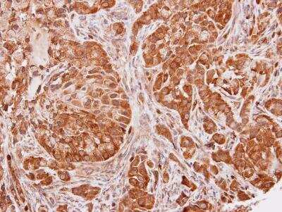 Immunohistochemistry-Paraffin: SEC13 Antibody [NBP1-33291] - Paraffin-embedded A549 xenograft, using antibody at 1:100 dilution.