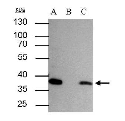 Immunoprecipitation: SEC13 Antibody [NBP1-33291] - HepG2 whole cell lysate/extract A : 30 ug whole cell lysate/extract of SEC13L1 protein expressing HepG2 cells B : Control with 2.5 ug of pre-immune rabbit IgG C : Immunoprecipitation of SEC13L1 by 2.5 ug of SEC13L1 antibody 10% SDS-PAGE The immunoprecipitated SEC13L1 protein was detected by SEC13L1 antibody diluted at 1:1000. EasyBlot anti-rabbit IgG (HRP) was used as a secondary reagent.