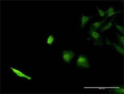 Immunocytochemistry/Immunofluorescence: SEC13L1 Antibody (1G7) [H00006396-M02] - Analysis of monoclonal antibody to SEC13 on HeLa cell . Antibody concentration 40 ug/ml.