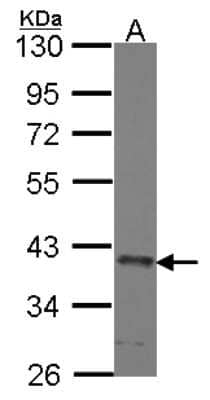 Western Blot: SEC13 Antibody [NBP2-20278] - Sample (30 ug of whole cell lysate) A: A431 10% SDS PAGE gel, diluted at 1:1000.