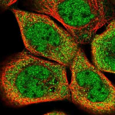 Immunocytochemistry/Immunofluorescence: SEC14L1 Antibody [NBP1-80882] - Immunofluorescent staining of human cell line A-431 shows localization to nucleoplasm & cytosol.