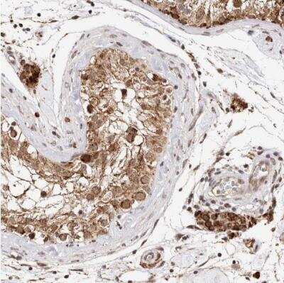 Immunohistochemistry-Paraffin: SEC14L1 Antibody [NBP1-80882] - Staining of human testis shows strong cytoplasmic positivity in Leydig cells.