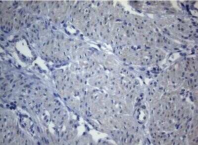 Immunohistochemistry: SEC14L1 Antibody (OTI3A6) - Azide and BSA Free [NBP2-74046] - Staining of paraffin-embedded Human endometrium tissue within the normal limits using anti-SEC14L1 mouse monoclonal antibody.