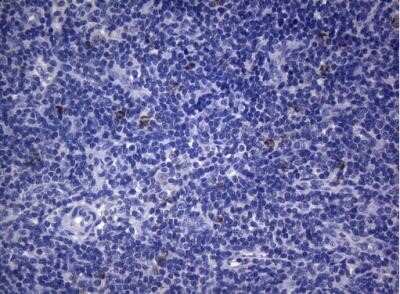 Immunohistochemistry: SEC14L1 Antibody (OTI3A6) - Azide and BSA Free [NBP2-74046] - Staining of paraffin-embedded Human lymph node tissue within the normal limits using anti-SEC14L1 mouse monoclonal antibody.