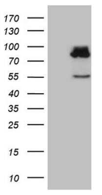 Western Blot: SEC14L1 Antibody (OTI3A6) - Azide and BSA Free [NBP2-74046] - HEK293T cells were transfected with the pCMV6-ENTRY control (Left lane) or pCMV6-ENTRY SEC14L1 (Right lane) cDNA for 48 hrs and lysed. Equivalent amounts of cell lysates (5 ug per lane) were separated by SDS-PAGE and immunoblotted with anti-SEC1.