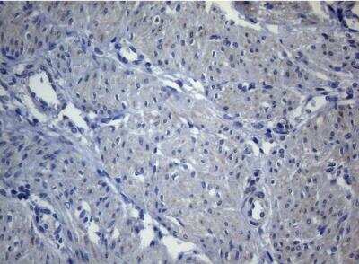 Immunohistochemistry-Paraffin: SEC14L1 Antibody (OTI3A6) [NBP2-45729] - Staining of paraffin-embedded Human endometrium tissue within the normal limits using anti-SEC14L1 mouse monoclonal antibody. 