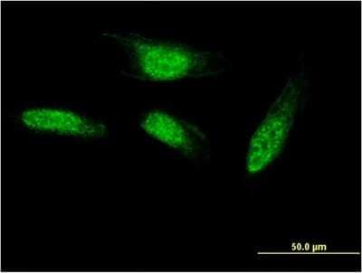 Immunocytochemistry/Immunofluorescence: SEC14L2 Antibody (2E5) [H00023541-M05] - Analysis of monoclonal antibody to SEC14L2 on HeLa cell. Antibody concentration 10 ug/ml